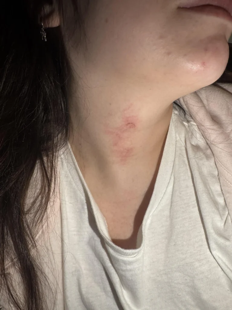 Jordyn Lee moved to Amsterdam with her boyfriend in December