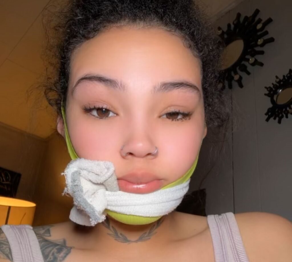 Shaylah Roberts says her teeth began rotting during pregnancy and are now beyond saving