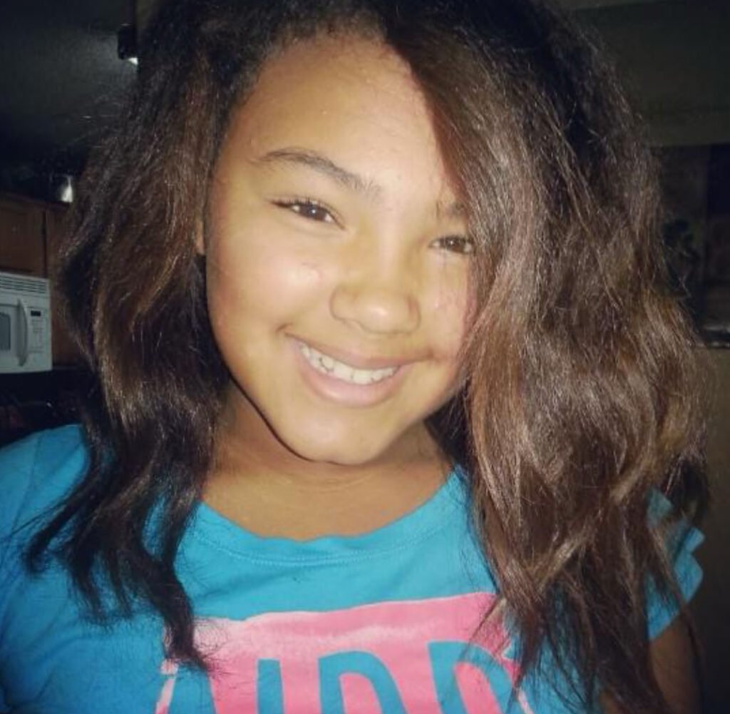 Shaylah Roberts says her teeth began rotting during pregnancy and are now beyond saving