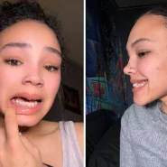Shaylah Roberts says her teeth began rotting during pregnancy and are now beyond saving