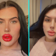 Sofia known as Britain's biggest lips