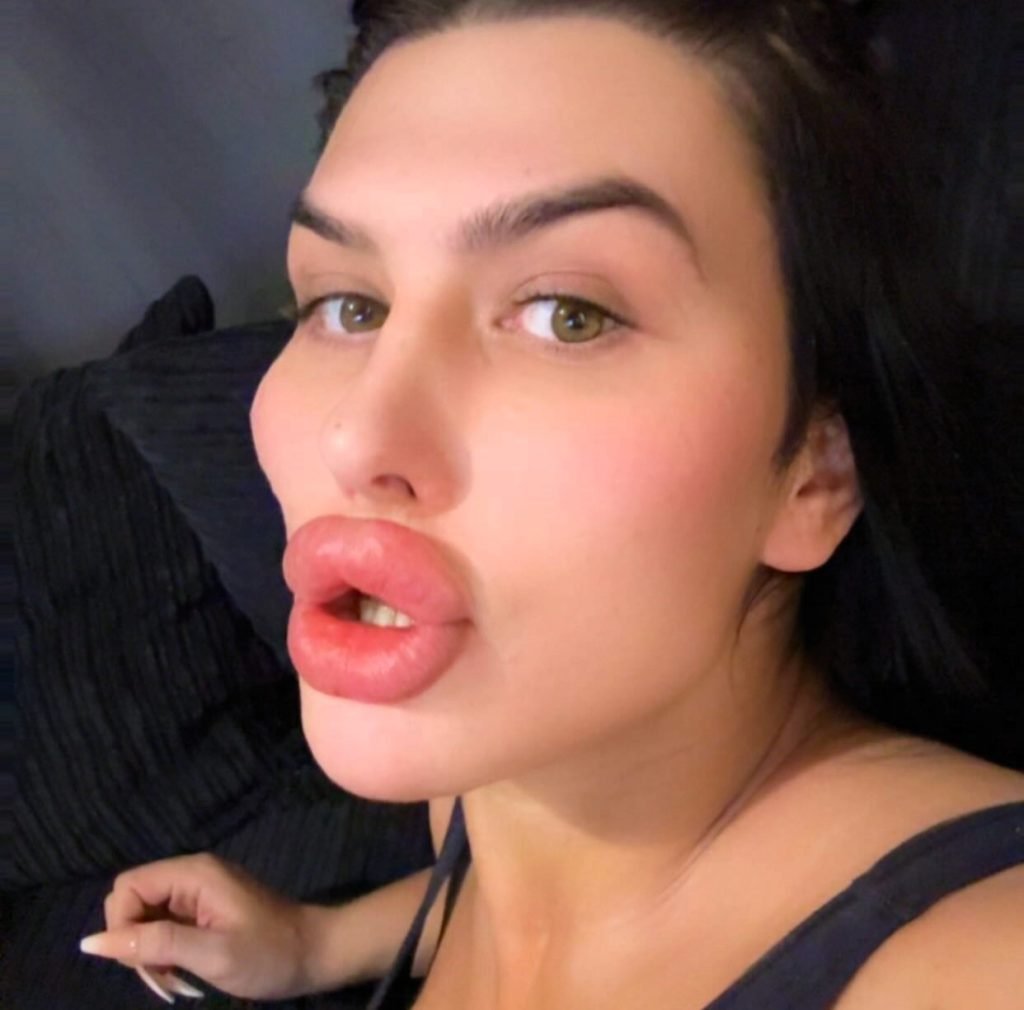 Sofia known as Britain's biggest lips