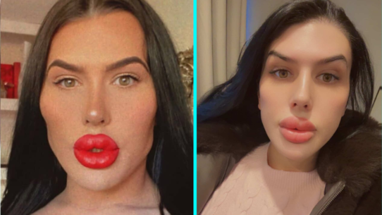 Sofia known as Britain's biggest lips