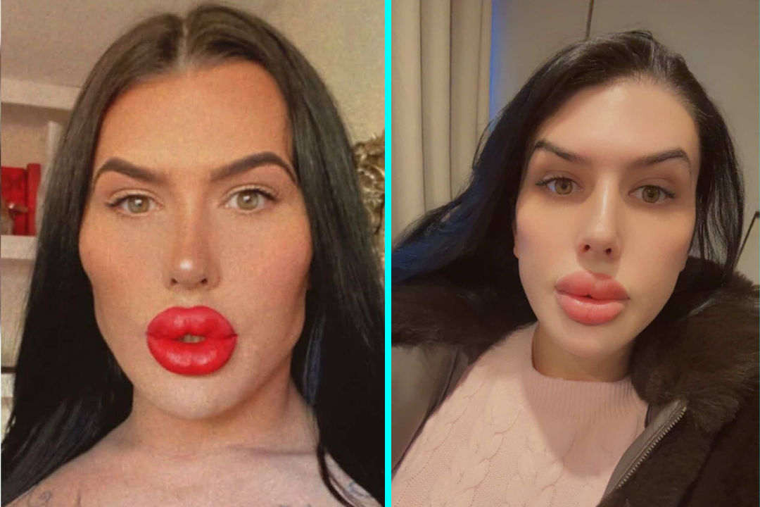 Sofia known as Britain's biggest lips
