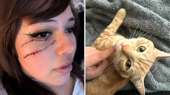 Vanessa Contreras Ruiz, 19, woke up bleeding after her cat Otis pushed off her face while she slept