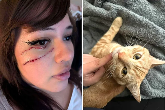 Vanessa Contreras Ruiz, 19, woke up bleeding after her cat Otis pushed off her face while she slept