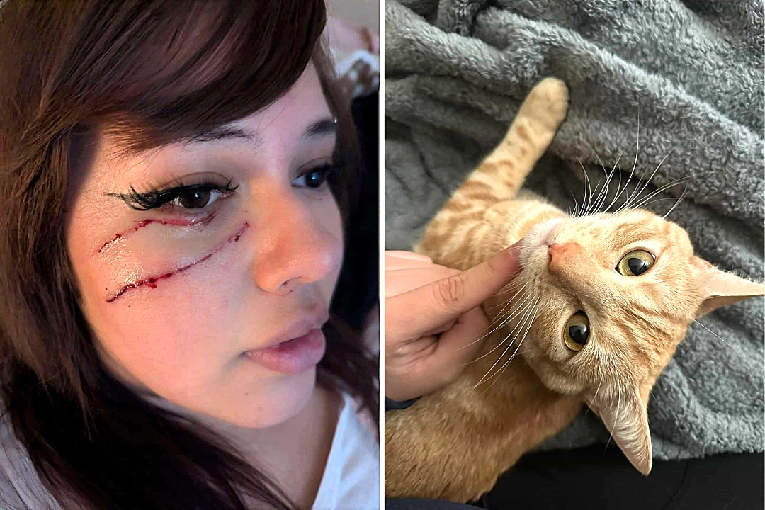 Vanessa Contreras Ruiz, 19, woke up bleeding after her cat Otis pushed off her face while she slept