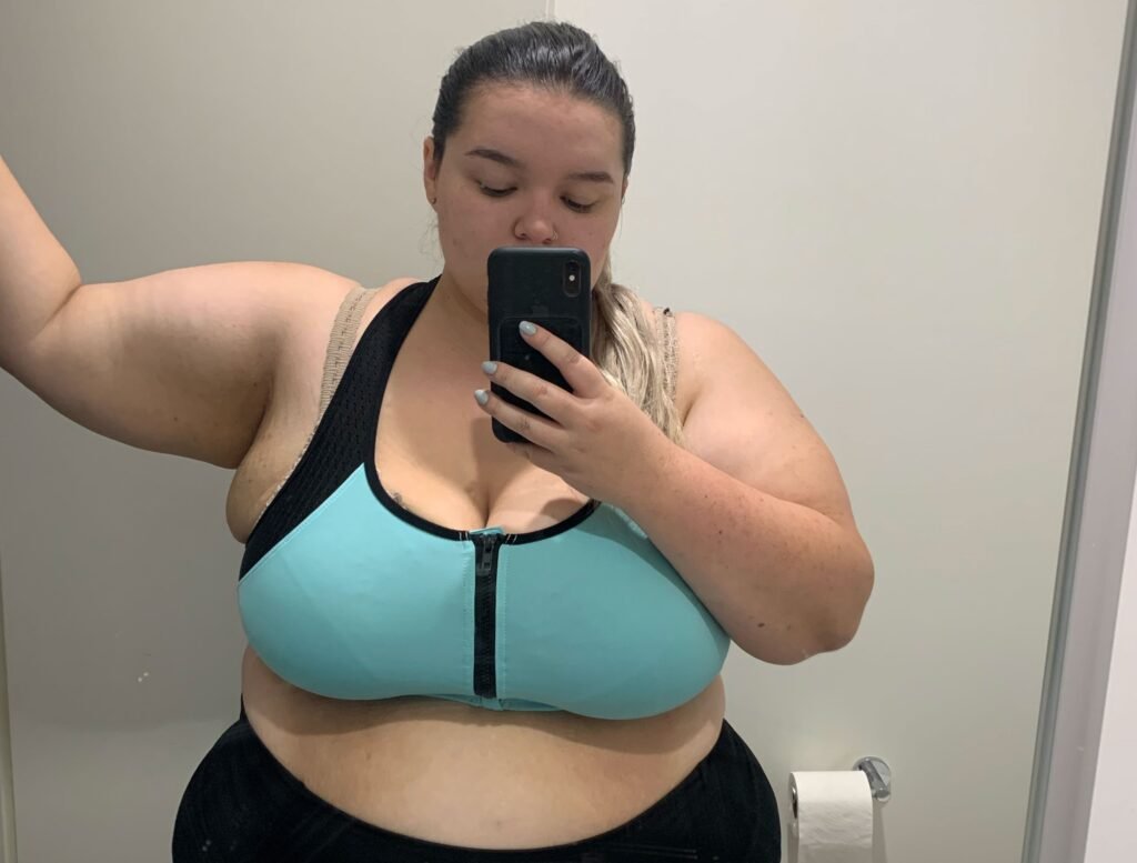 years – then faced a $100,000 bill for skin removal surgery