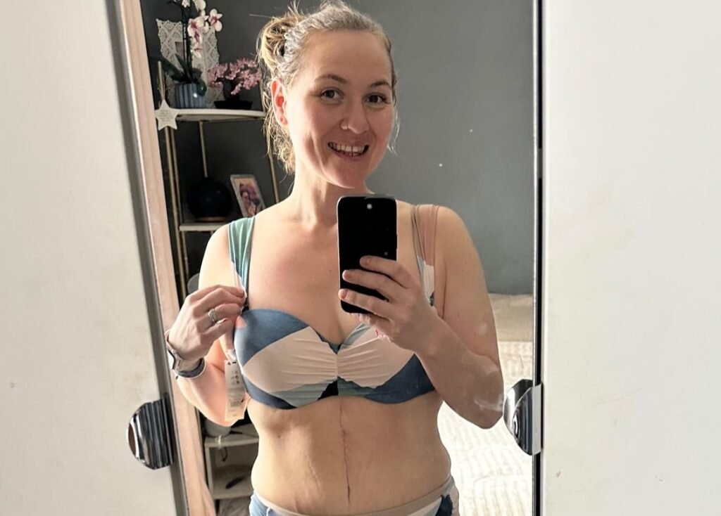 Natalie Strange, 37, used weight loss jabs to shed 10 stone