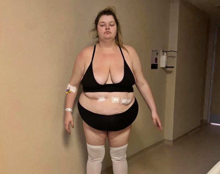 Ellie Jefferies lost 12 stone and stunned millions on TikTok with her resemblance to Margot Robbie