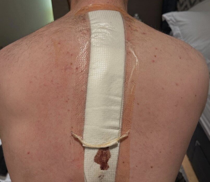 Ed Boyd's heart stopped twice after a 65kmph cycling crash