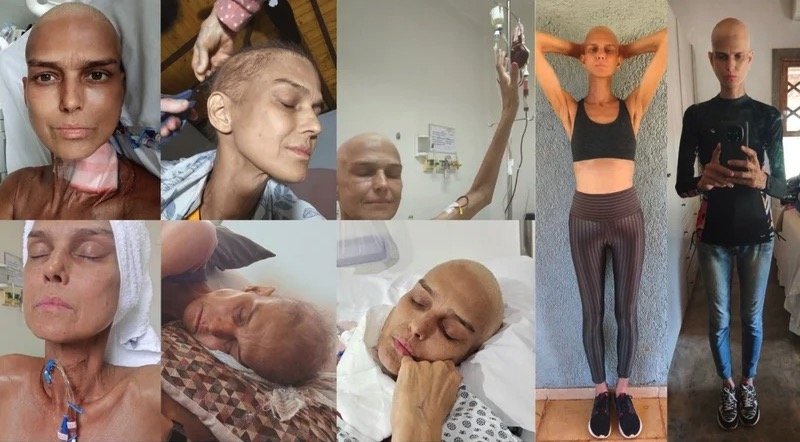 Voice Brasil singer Karina Zeviani, 51, has revealed she almost lost her life after a biopsy complication led to emergency surgery