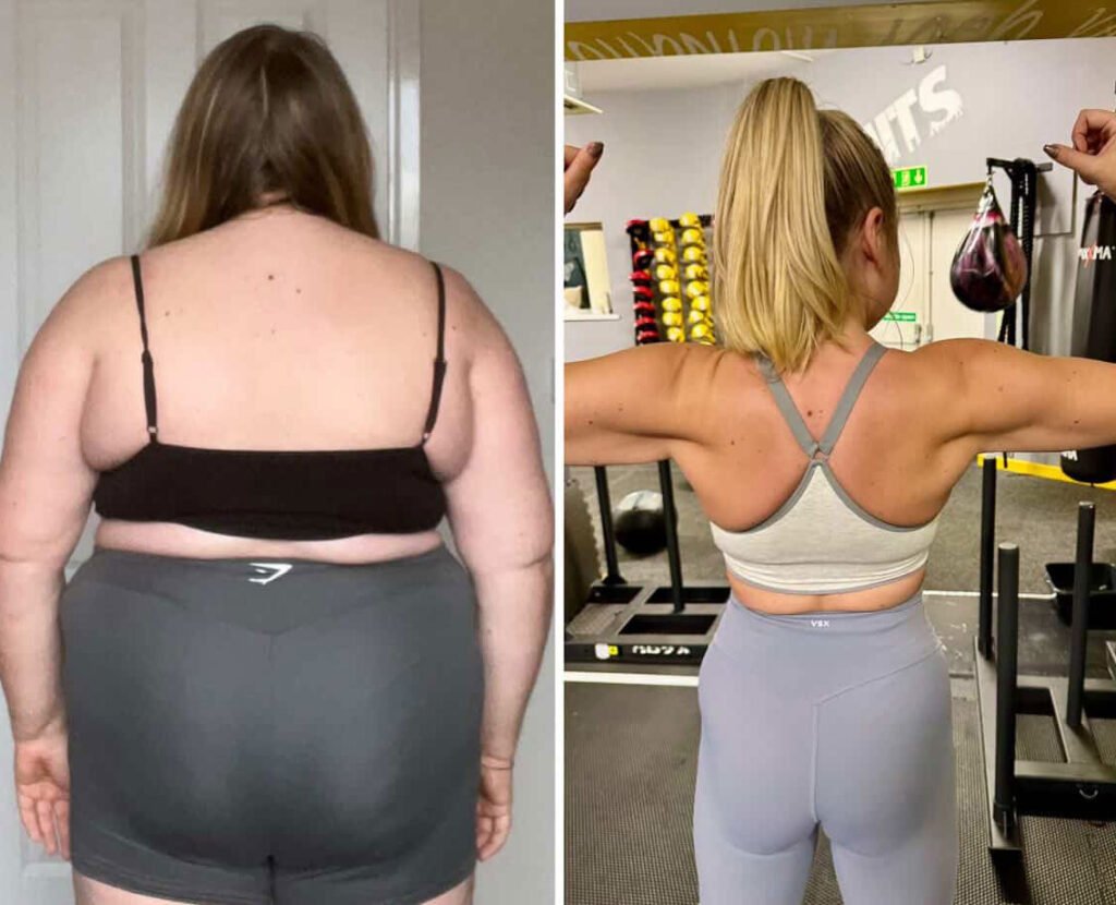 Teacher Becka Gill lost over 10 stone after gastric sleeve surgery and Mounjaro jabs