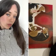 Kate Markham was born with a rare condition that causes folds in her skin