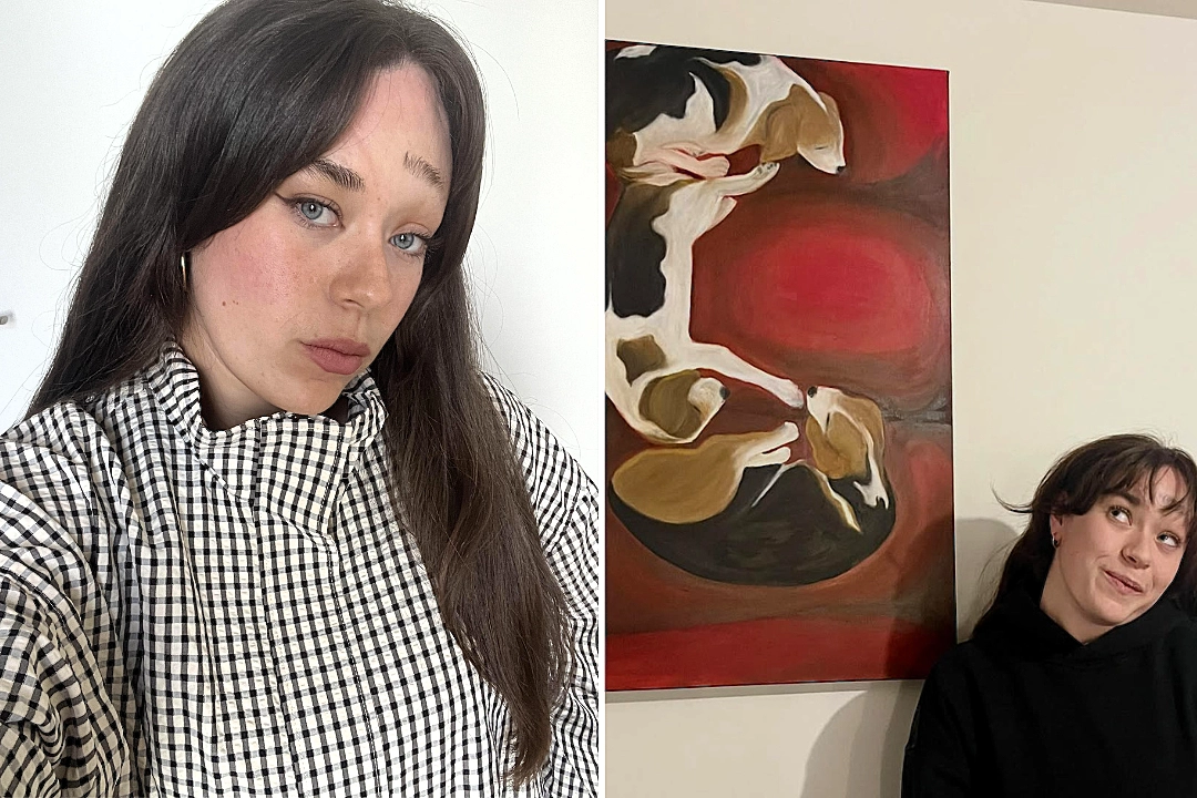 Kate Markham was born with a rare condition that causes folds in her skin