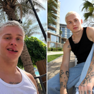 Russian influencer Dania Milokhin, 24, lost his front tooth on a children's pool slide in Dubai