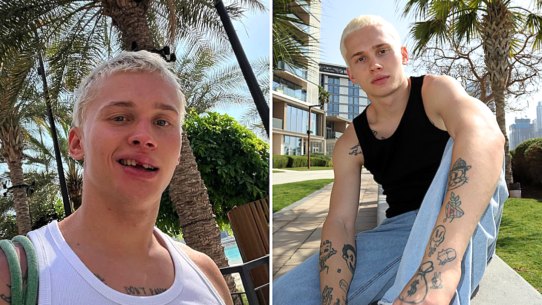Russian influencer Dania Milokhin, 24, lost his front tooth on a children's pool slide in Dubai