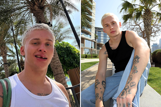 Russian influencer Dania Milokhin, 24, lost his front tooth on a children's pool slide in Dubai
