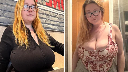 Tianna Moon found out she had gigantomastia last year
