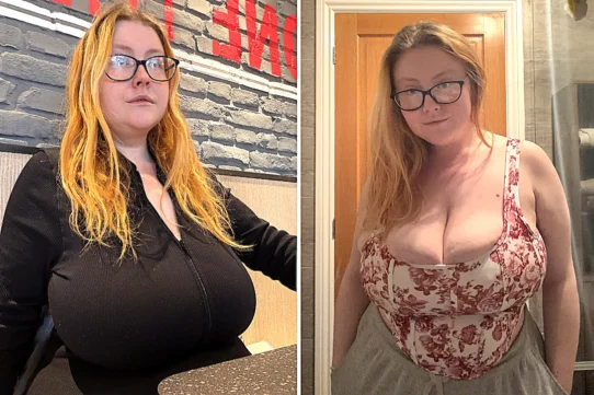 Tianna Moon found out she had gigantomastia last year