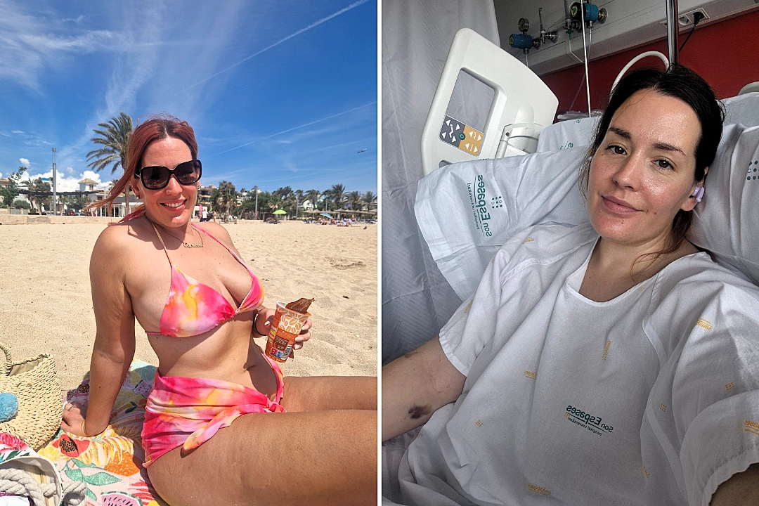 Social media manager Charlie Wilson woke up sore in Mallorca