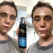 Olivia Hall ran out of her usual fake tan and grabbed a spare