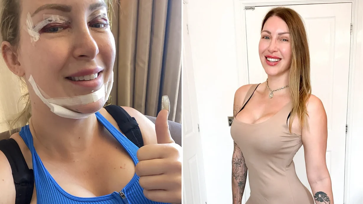 Tracy Kiss spent over £100,000 on surgery across 20 years