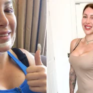 Tracy Kiss spent over £100,000 on surgery across 20 years
