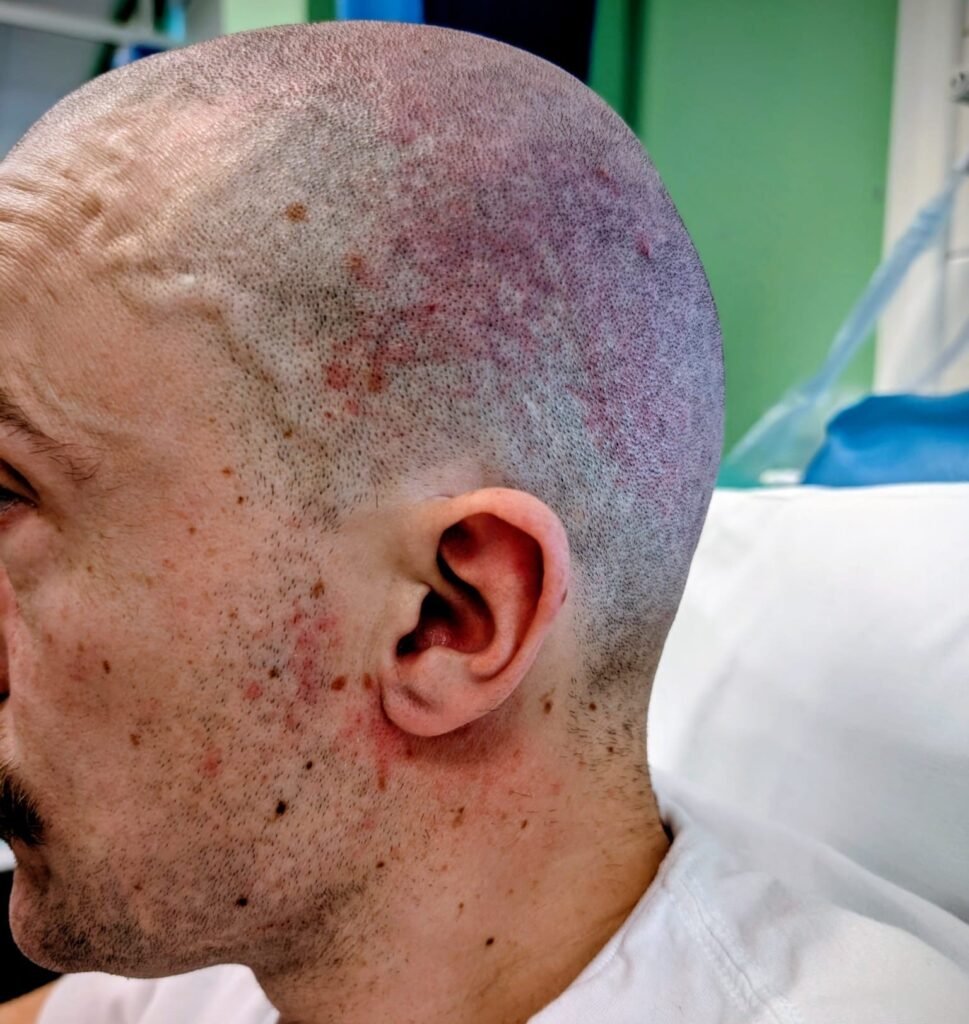 Jack Parker fought cancer through chemo while his firm kept paying him by mistake