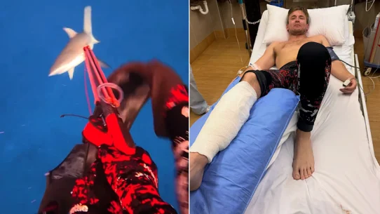 Fishing creator Henry Gibbs needed four surgeries and a skin graft after a grey reef shark attack in Fiji