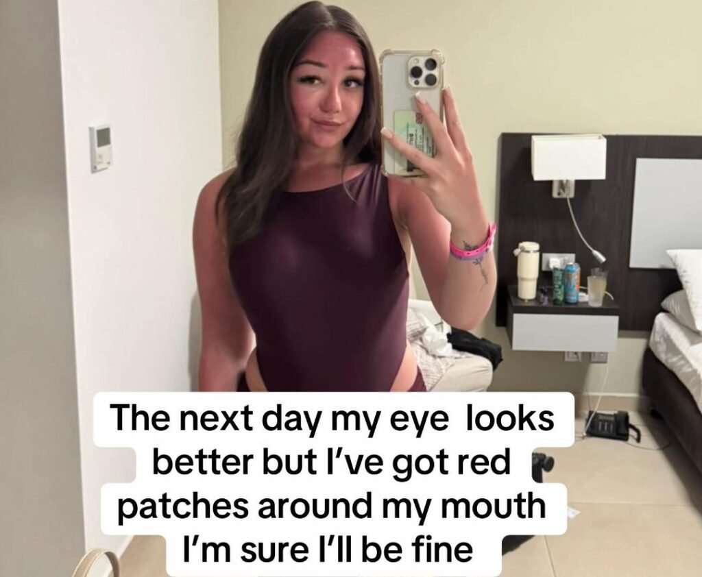 Phoenix McPike spotted a heavy eye bag on her Greek holiday