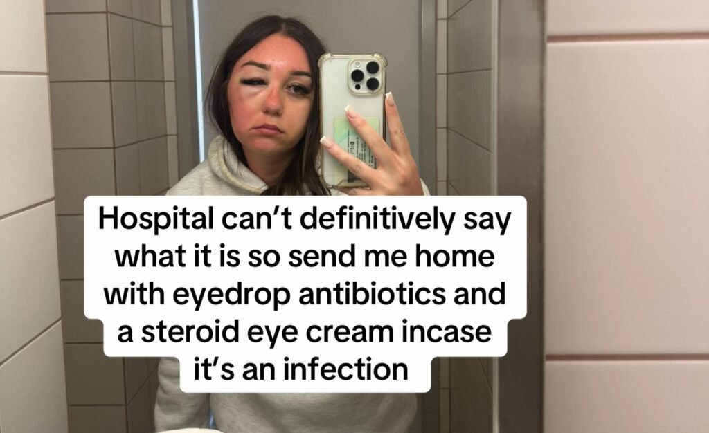 Phoenix McPike spotted a heavy eye bag on her Greek holiday