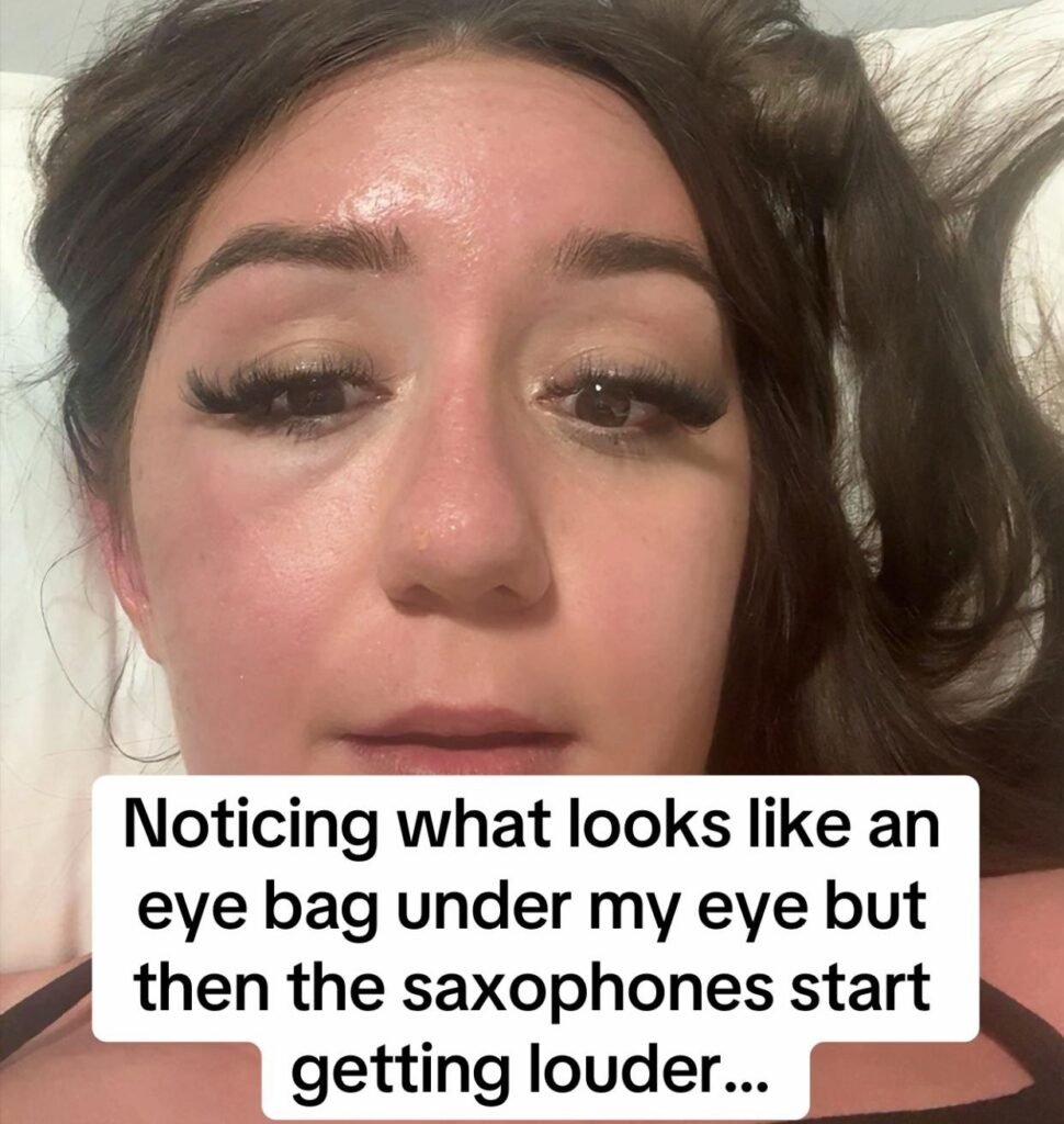 Phoenix McPike spotted a heavy eye bag on her Greek holiday