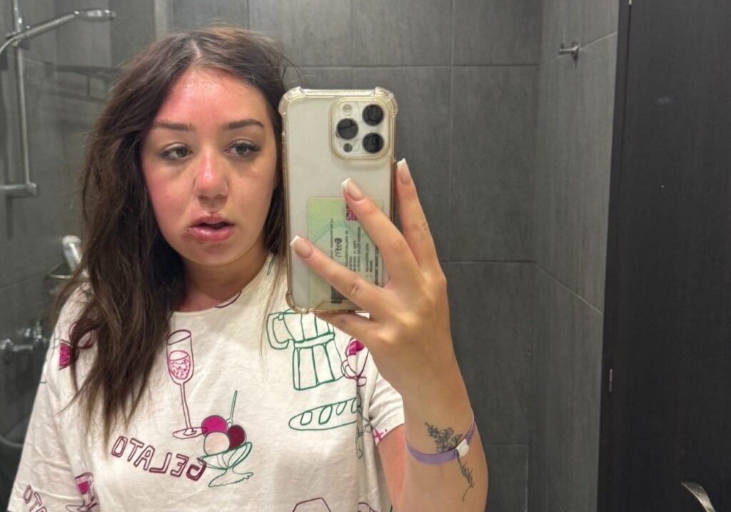 Phoenix McPike spotted a heavy eye bag on her Greek holiday
