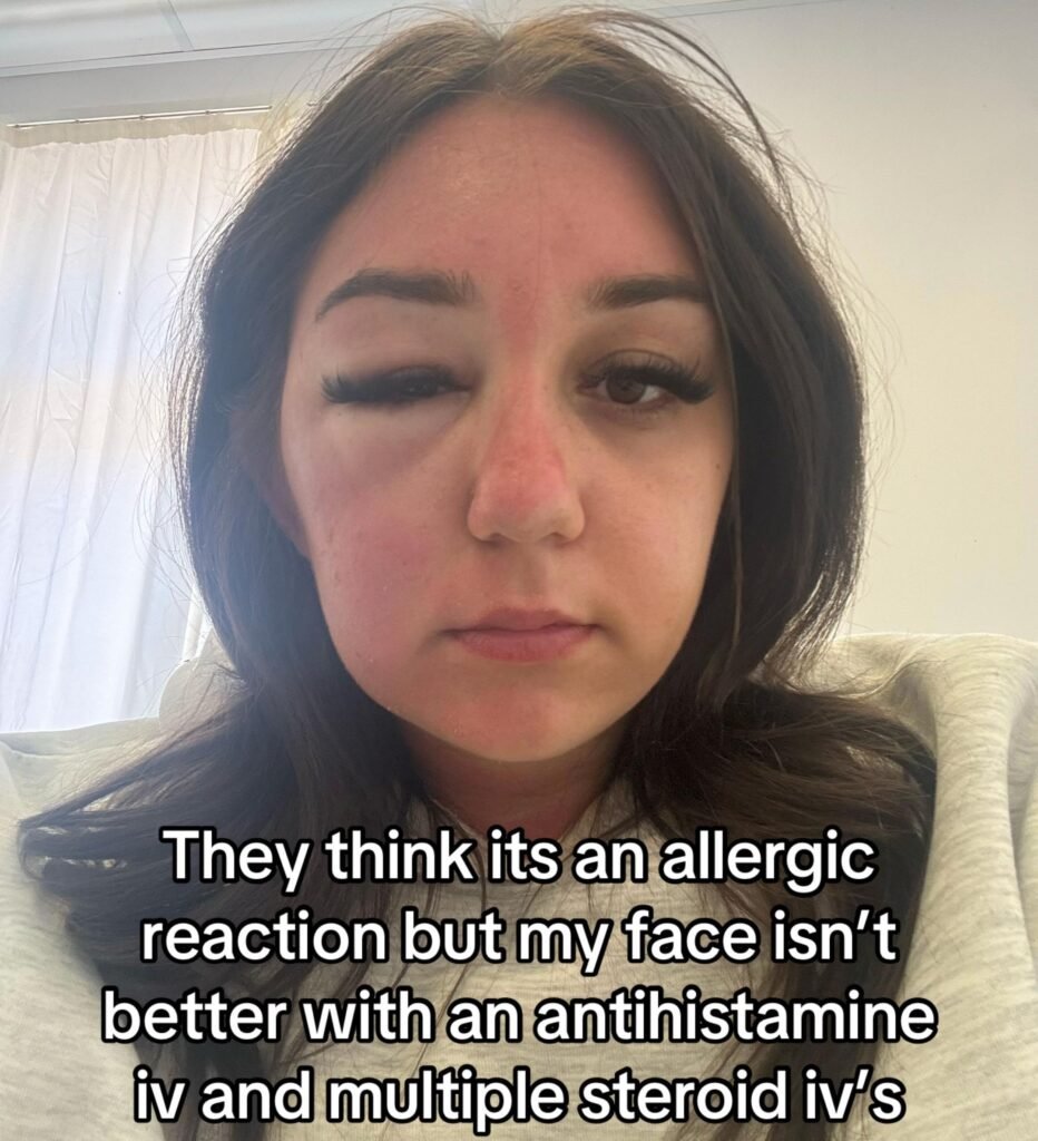 Phoenix McPike spotted a heavy eye bag on her Greek holiday