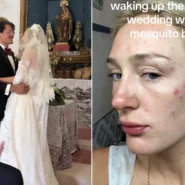Bride Auja Smith woke on her wedding morning covered in 50 swollen mosquito bites