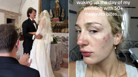 Bride Auja Smith woke on her wedding morning covered in 50 swollen mosquito bites