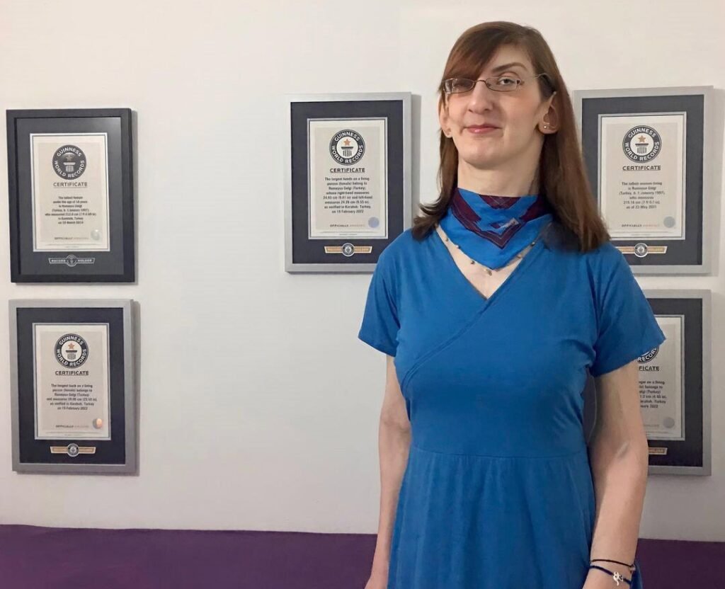 Rumeysa Gelgi, the world's tallest woman, lived 29 years with the wrong diagnosis