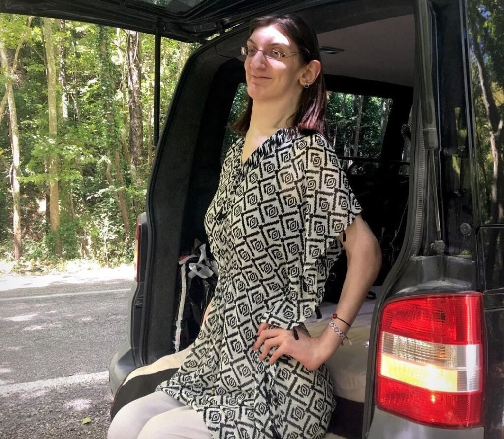 Rumeysa Gelgi, the world's tallest woman, lived 29 years with the wrong diagnosis