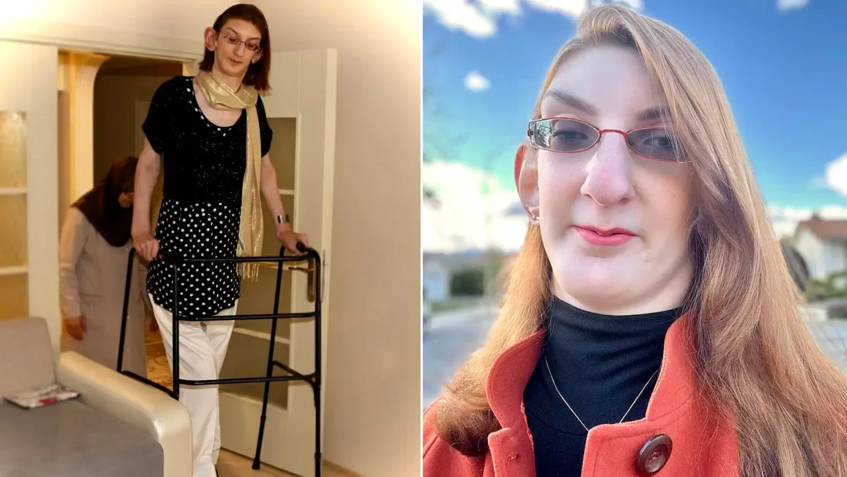 Rumeysa Gelgi, the world's tallest woman, lived 29 years with the wrong diagnosis
