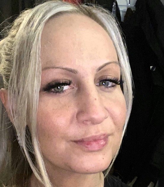 Kajsa Ziebell refused Botox to avoid a 'marshmallow face'