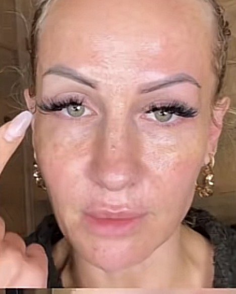 Kajsa Ziebell refused Botox to avoid a 'marshmallow face'