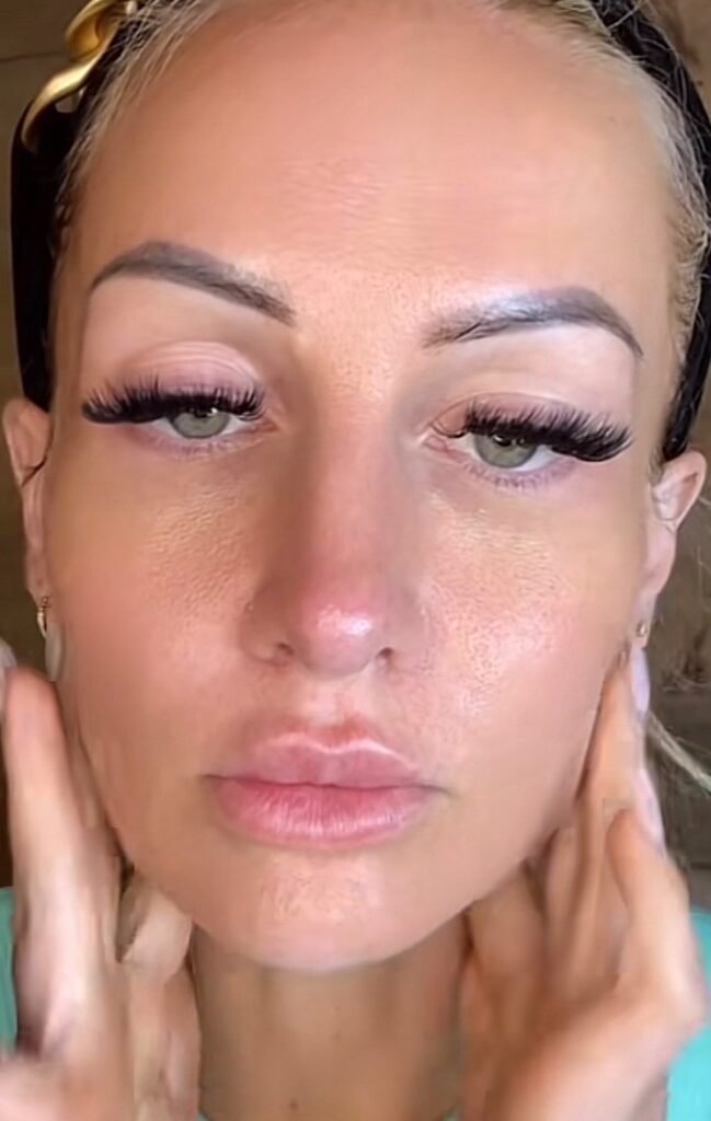 Kajsa Ziebell refused Botox to avoid a 'marshmallow face'