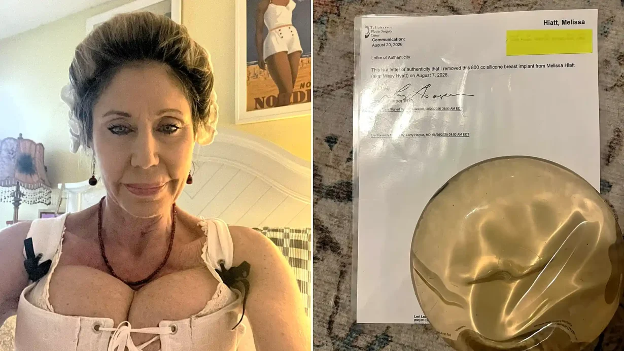 Wrestling's 'First Lady' Missy Hyatt sold her old breast implant to a fan for £1,500 after a week of bidding