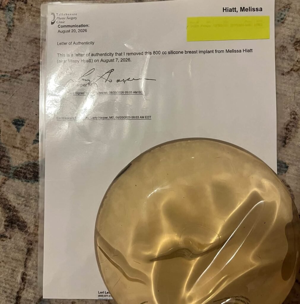 Wrestling's 'First Lady' Missy Hyatt sold her old breast implant to a fan for £1,500 after a week of bidding