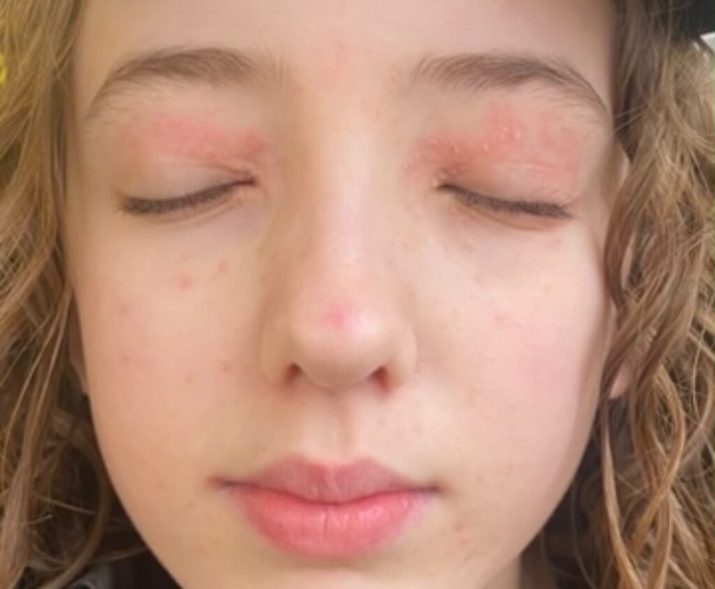 Sienna Sorby, 14, tried adult anti-ageing skincare at a sleepover because the packaging looked cute