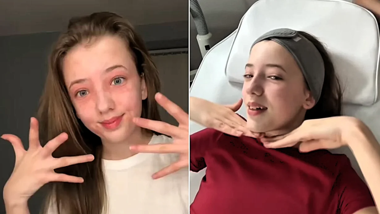 Sienna Sorby, 14, tried adult anti-ageing skincare at a sleepover because the packaging looked cute