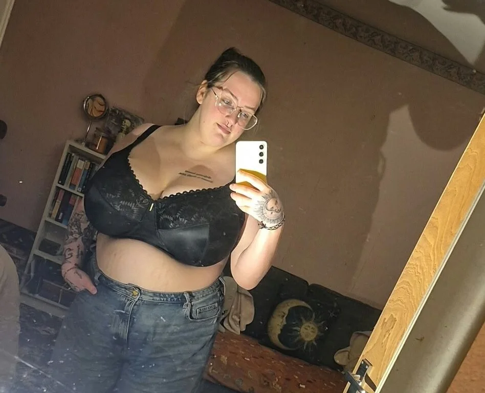 Woman with size K breasts wants them completely removed due to severe pain, £90 bras and constant unwanted attention from strangers in public.
