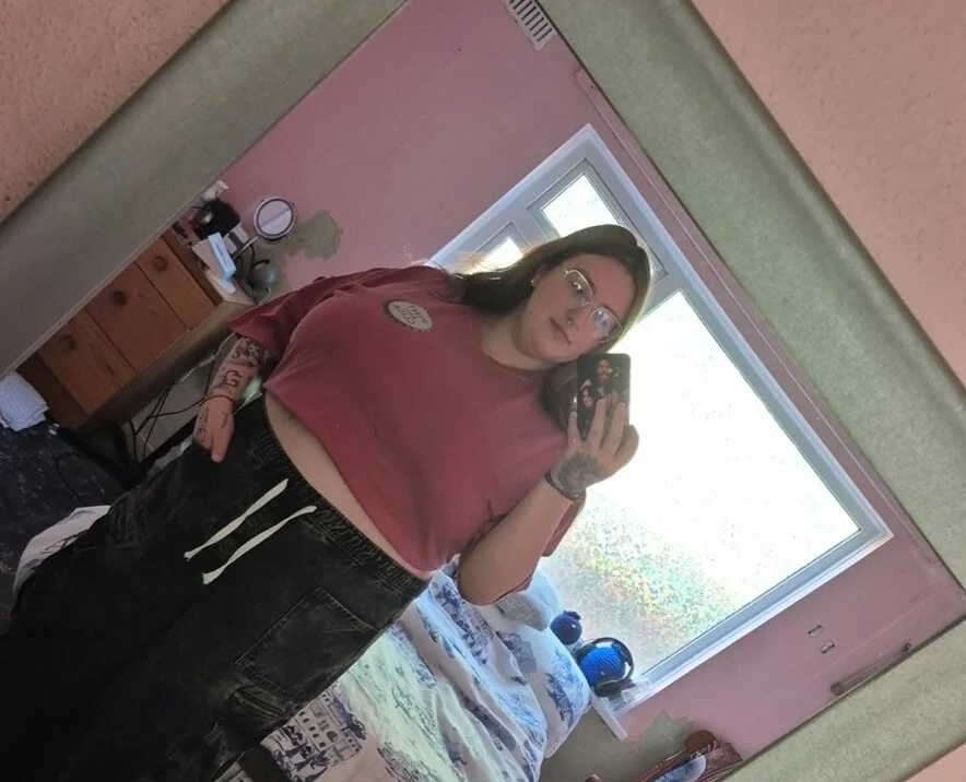 Woman with size K breasts wants them completely removed due to severe pain, £90 bras and constant unwanted attention from strangers in public.
