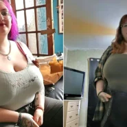 Woman with size K breasts wants them completely removed due to severe pain, £90 bras and constant unwanted attention from strangers in public.